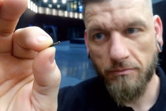 Cấy chip vào người sống - trào lưu đang nổi lên toàn cầu