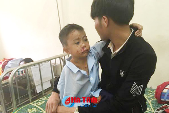 dot kip min anh em ruot nhap vien cap cuu