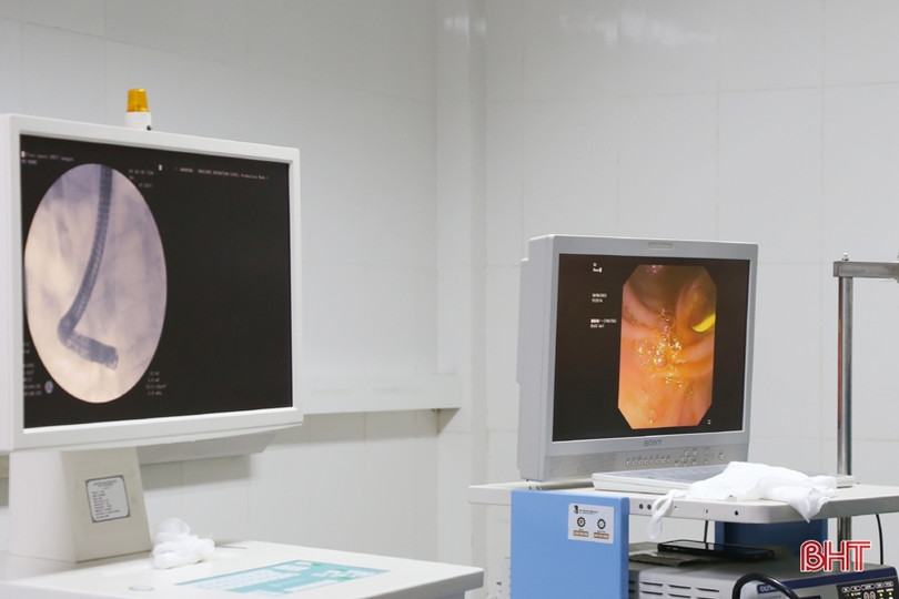 BVĐK Hà Tĩnh tiếp nhận kỹ thuật nội soi mật tụy ngược dòng lấy sỏi