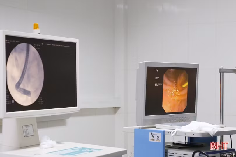 BVĐK Hà Tĩnh tiếp nhận kỹ thuật nội soi mật tụy ngược dòng lấy sỏi