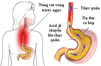 luu y khi mac chung trao nguoc da day