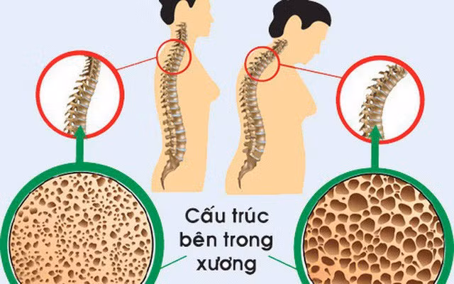 cham moc 30 ban se phai doi mat voi 1 loat thay doi nay tren co the