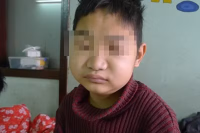 xuc xich bim co the khien tre mac benh than loang xuong