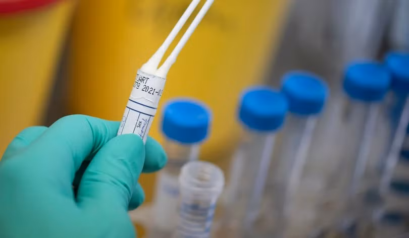 Hiểu được cơ chế tàn phá của virus cũng như cơ chế phản kháng của cơ thể là thiết yếu trong việc chống virus. Ảnh: AFP . Trận chiến khốc liệt giữa hệ miễn dịch người với virus corona