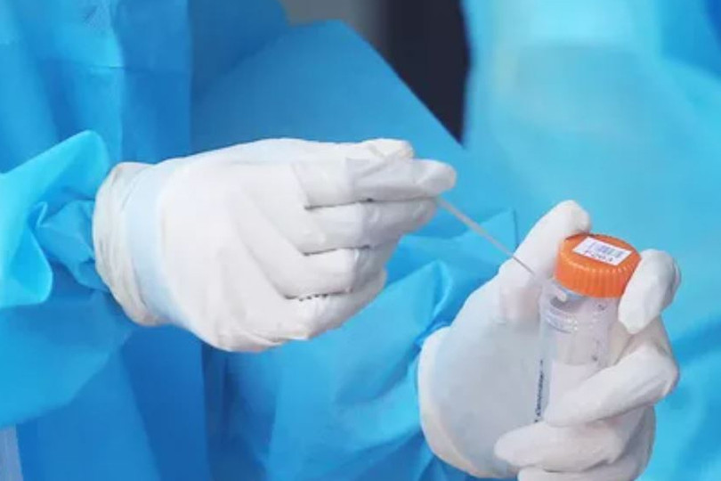 Số mắc COVID-19 trong cả nước giảm xuống còn 83.376 ca ảnh 2 Số mắc COVID-19 trong cả nước giảm xuống còn 83.376 ca