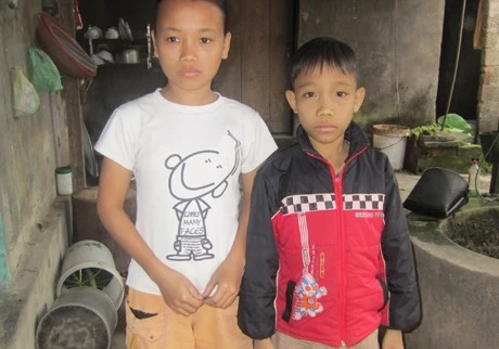 Không được chuyền máu kịp thời nên chi em Nhung - Sơn da dẻ vàng vọt, ốm yếu