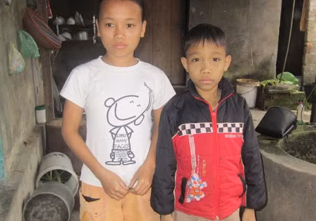 Không được chuyền máu kịp thời nên chi em Nhung - Sơn da dẻ vàng vọt, ốm yếu