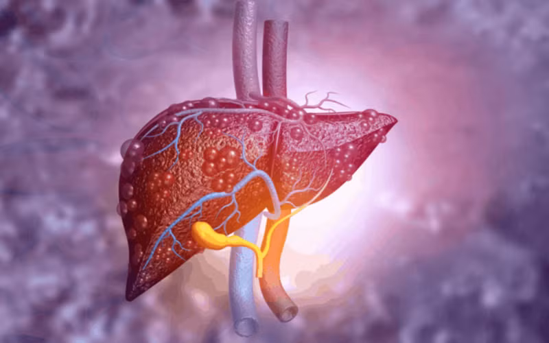 Tác hại của thức ăn nhanh đối với sức khỏe