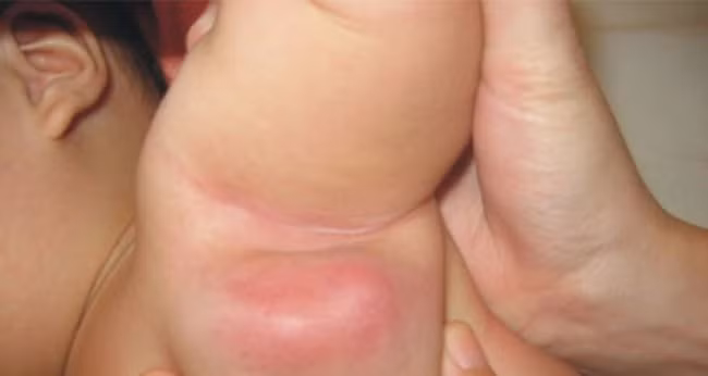 hiem hoa ung thu da tu thoi quen dung lan khu mui