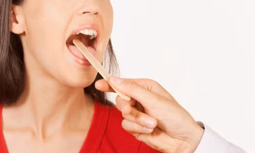 lai rai nhu tai mui hong lam sao de chua dut diem