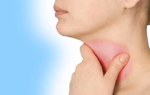 lai rai nhu tai mui hong lam sao de chua dut diem