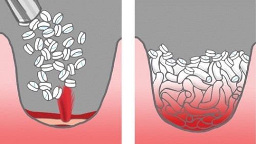 Cơ chế hoạt động của Xstat. Ảnh: Medium.