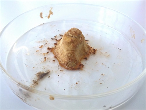 12 phát minh khoa học y như phép thần thông của năm 2015 ảnh 12 12 phát minh khoa học y như phép thần thông của năm 2015 ảnh 12