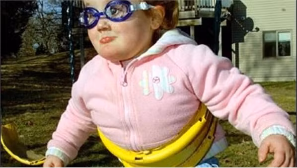 Bé Gabby Gingras ở Big Lake, Minnesota bị vô cảm bẩm sinh với mọi đau đớn.