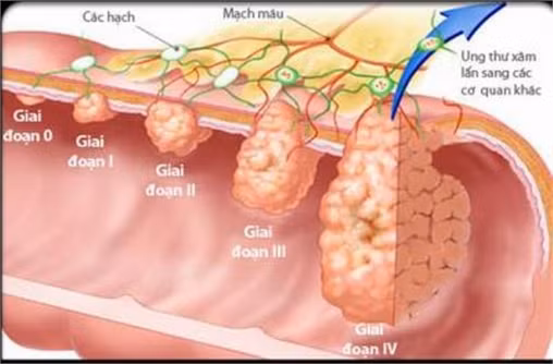 Những bệnh không nên dùng vitamin ảnh 2