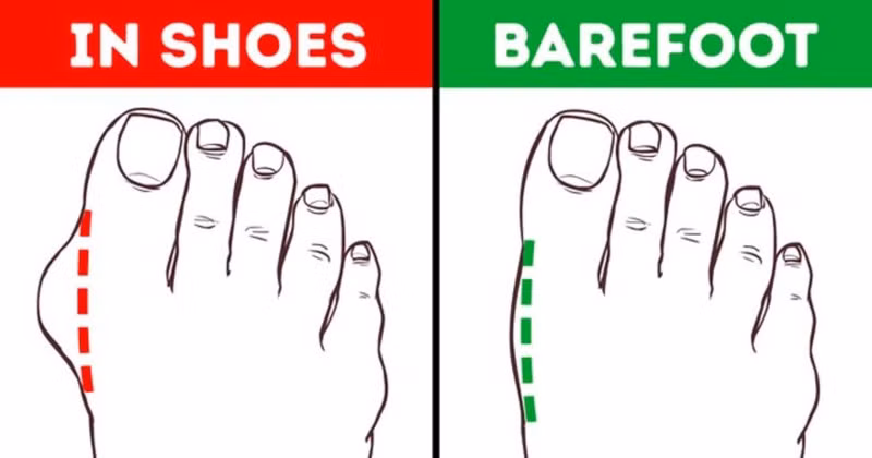 13 lợi ích sức khỏe khi bạn đi chân đất nhiều hơn