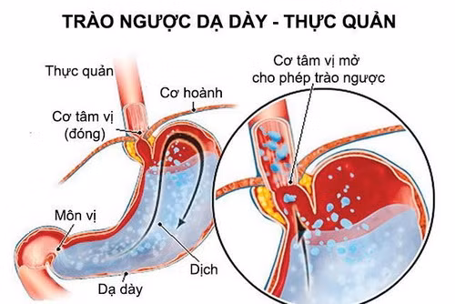 trao nguoc da day thuc quan cach nao de song chung