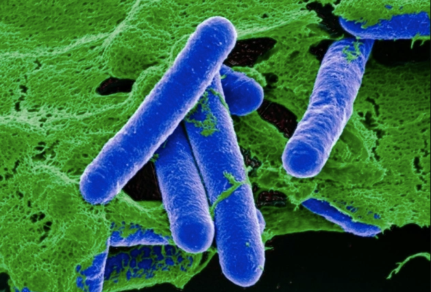 Vi khuẩn hình que sinh botulinum là độc tố kịch độc, có thể gây tử vong chỉ với lượng nhỏ. Ảnh:Nature