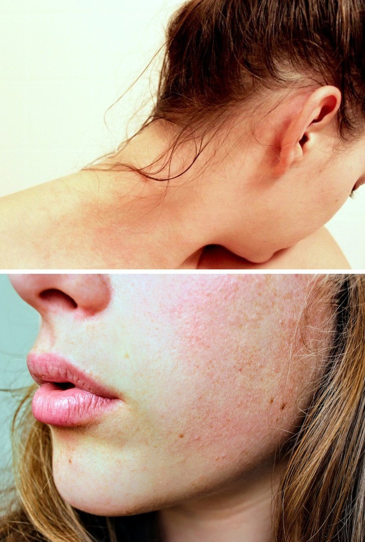 7 lý do khiến bạn không nên đi ngủ khi tóc ướt