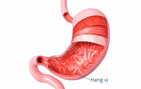 viem hang vi sung huyet co nguy hiem