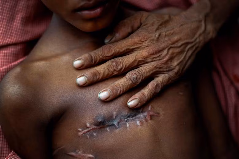 loat anh ve tham canh cua nguoi di cu rohingya dat giai pulitzer