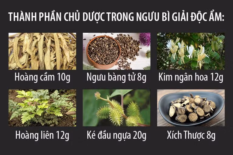 Cách chữa vảy nến da đầu tại nhà cùng chuyên gia Iwt Hà Nội
