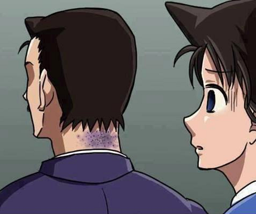 hai can benh tram kha cua si tu mua thi