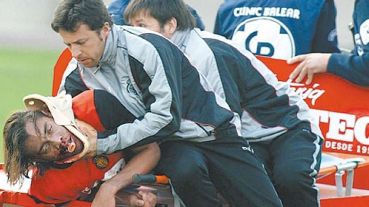 nhung pha chan thuong ghe ron tai tay ban nha