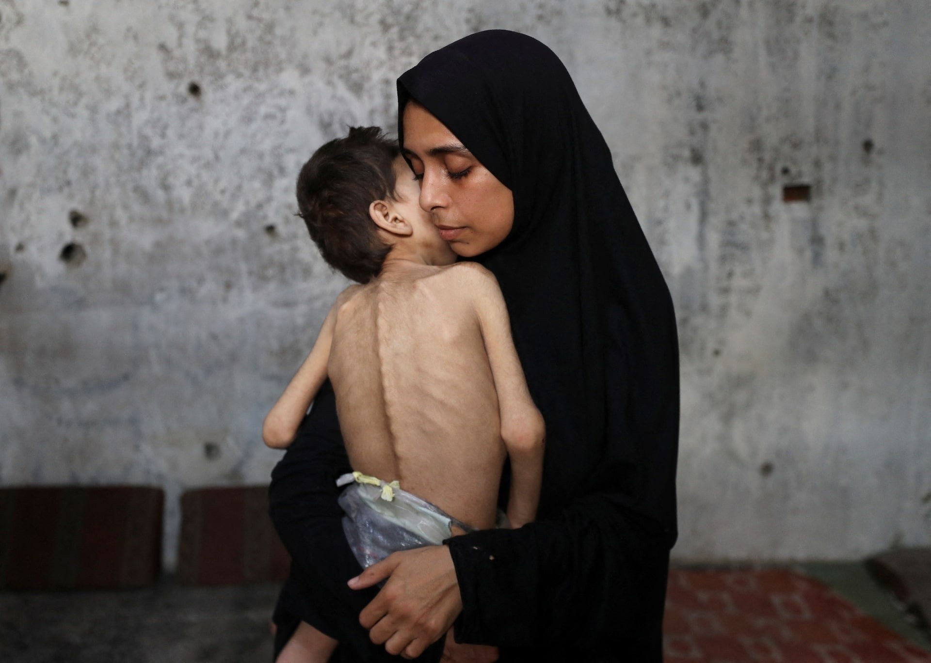 Chị Samah Matar ôm đứa con trai bị suy dinh dưỡng và bị bại não tại địa điểm cứu trợ ở Dải Gaza ngày 24/7.