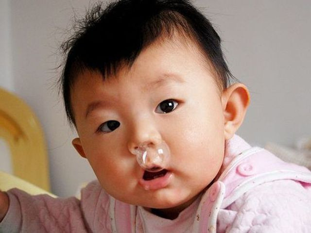 ho so mui.jpg Trẻ vài bữa lại sổ mũi một lần, là bệnh gì?