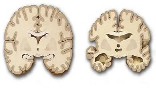 5 vấn đề về sức khỏe tuổi nào cũng có thể mắc, nhưng có thể phòng ngừa