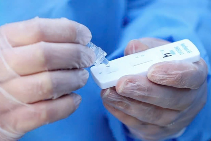 Nếu có bất kỳ triệu chứng nào của COVID-19, người dân cần test để xác định bệnh và điều trị kịp thời. Ảnh: internet 545.jpg