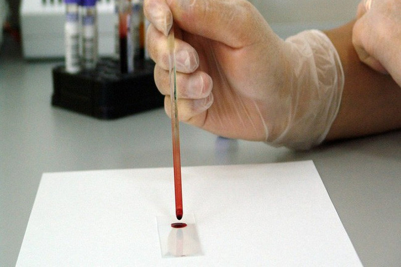 Phát minh thiết bị phát hiện vi khuẩn chỉ trong ít phút