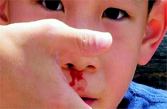 Chế tạo thành công bột ngăn chảy máu ảnh 1