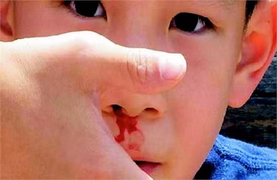 Chế tạo thành công bột ngăn chảy máu ảnh 1