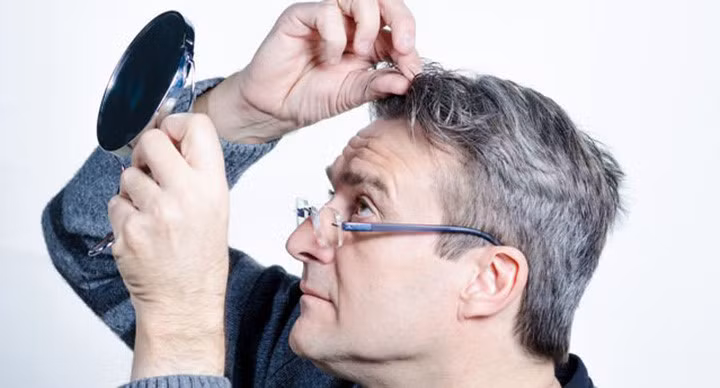 nguyen nhan nao khien toc bac som