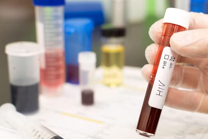 Người thứ 5 trên thế giới được chữa khỏi HIV