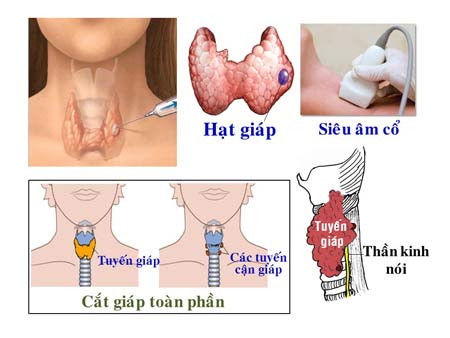 nhan biet buou nhan tuyen giap