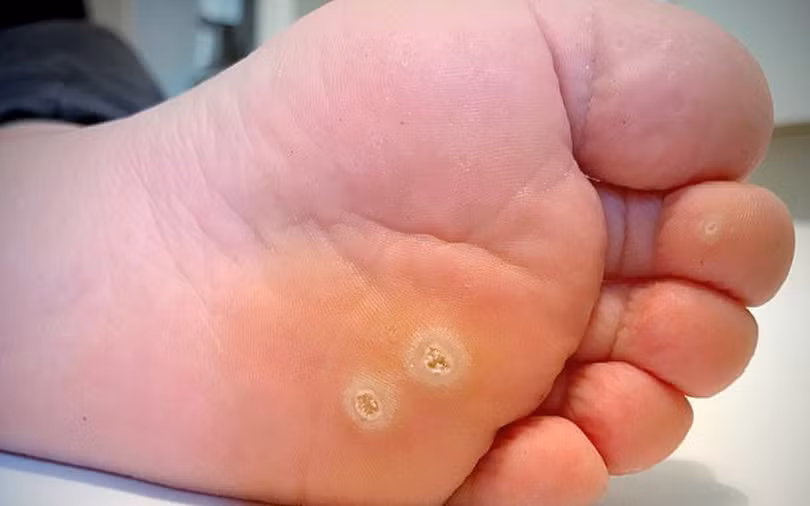 9 bệnh da liễu nguy hiểm ở trẻ