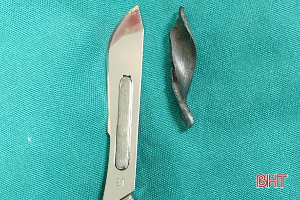 Phẫu thuật lấy mảnh kim loại đâm xuyên khớp háng cho bệnh nhân ở Thạch Hà