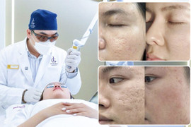 5 lý do đưa Phòng khám Da liễu LG luôn thuộc top đầu địa chỉ điều trị sẹo rỗ tại TP Hồ Chí Minh