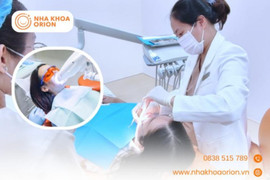 Tẩy trắng răng - giải pháp lấy lại nụ cười tự tin tại Nha khoa Orion