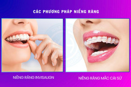 Đã bọc răng sứ có niềng răng được không?