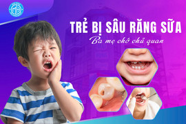 Sâu răng sữa ở trẻ, bố mẹ chớ chủ quan