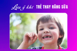 Những lưu ý quan trọng khi trẻ thay răng sữa