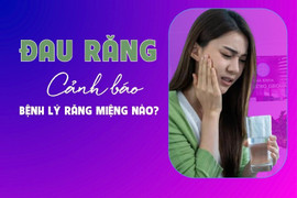 Đau răng cảnh báo bệnh lý răng miệng nào?