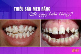 Thiểu sản men răng: Chớ xem thường!