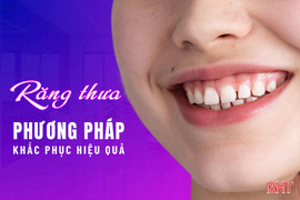 Phương pháp hiệu quả khắc phục răng thưa