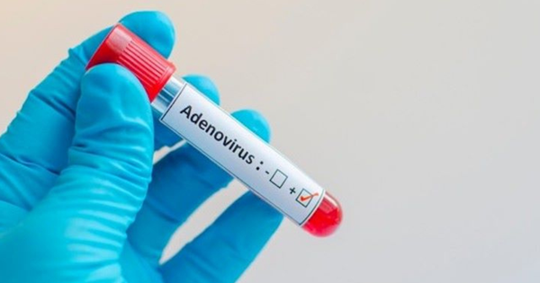 Khi nào nên xét nghiệm Adenovirus cho trẻ?