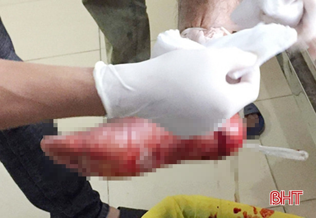 Đi cắt cỏ, bị máy cắt gần đứt lìa bàn chân